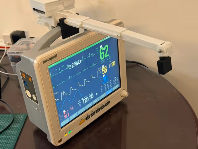 ArogyaSync IoT Module — Live Vitals Capture
